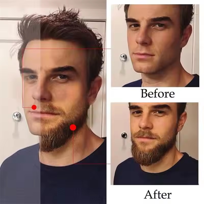 Fast Natural Mature Men Beard  - огляд і ціна Ingrown Hair Serum